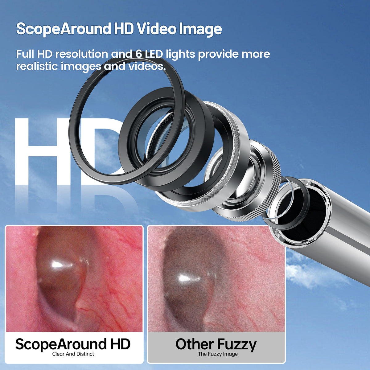 Otoscpy Ear Examination High Resolution USB Digital Otoscope โ ScopeAround