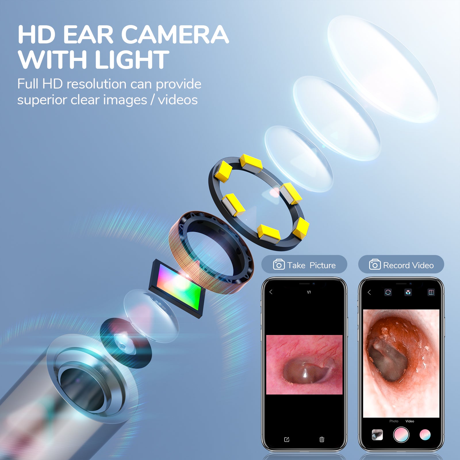 Ear Camerar USB Otoscope Ear Cleaning Kit for iPhone & Android – ScopeAround