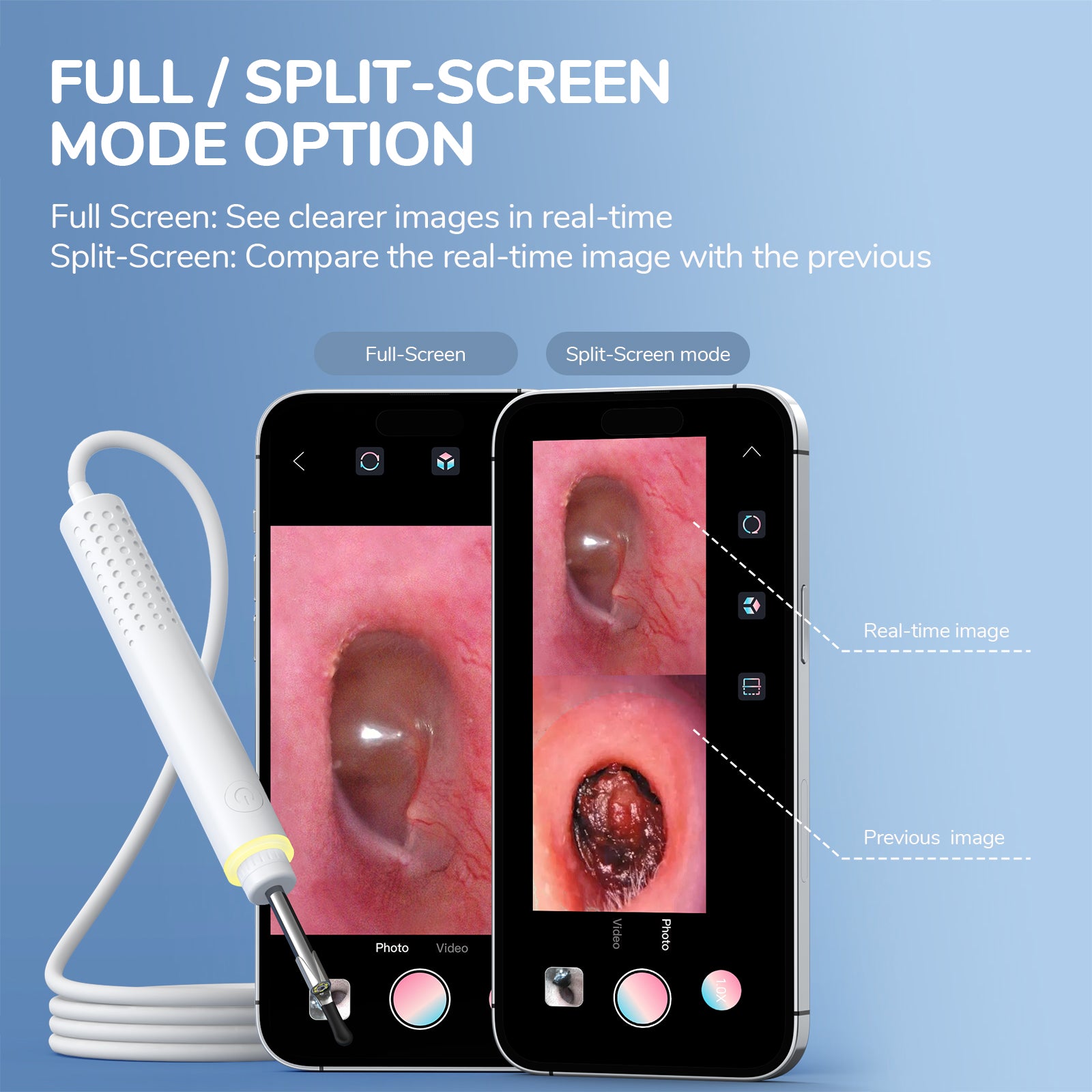 Android Scope Camera USB Otoscope Ear Cleaning Kit for iPhone & Android – ScopeAround