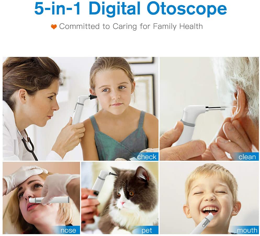 Wireless Otoscope: Ear Cleaning Camera with Ear Cleaning Kit – ScopeAround
